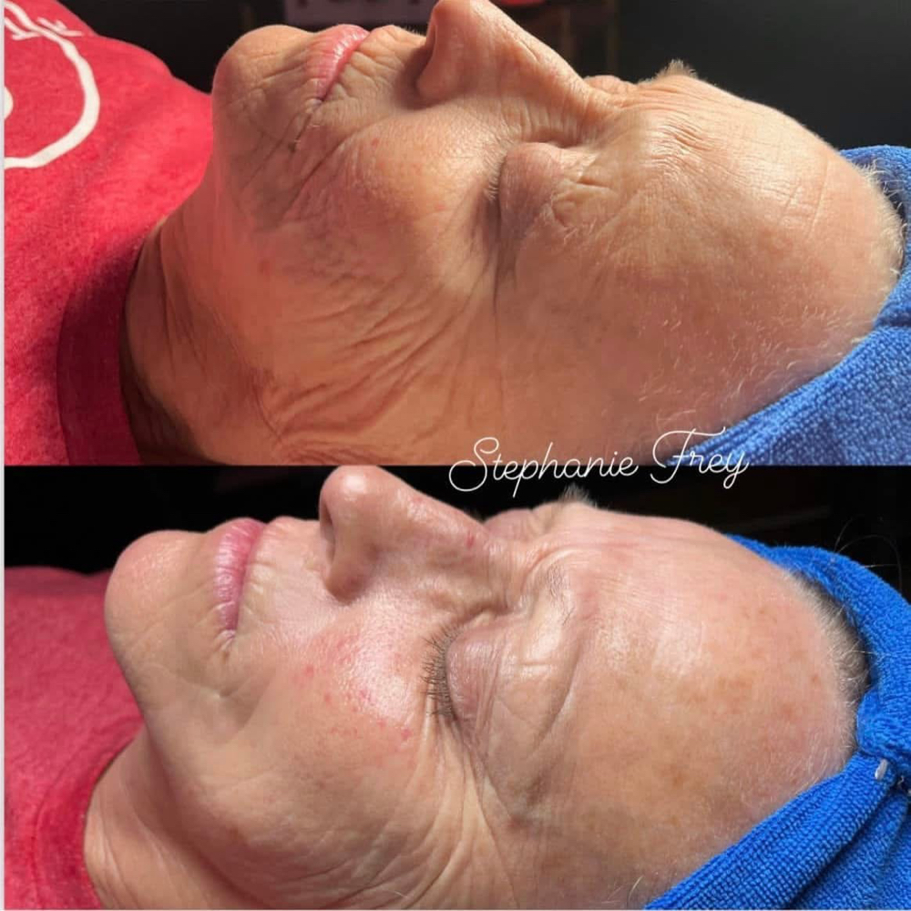 Instant Firming Facial