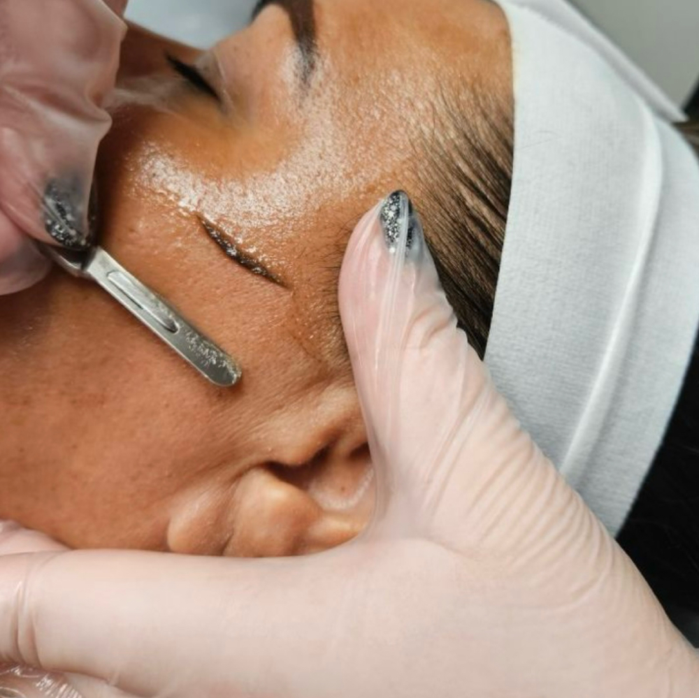 Add DERMAPLANE
