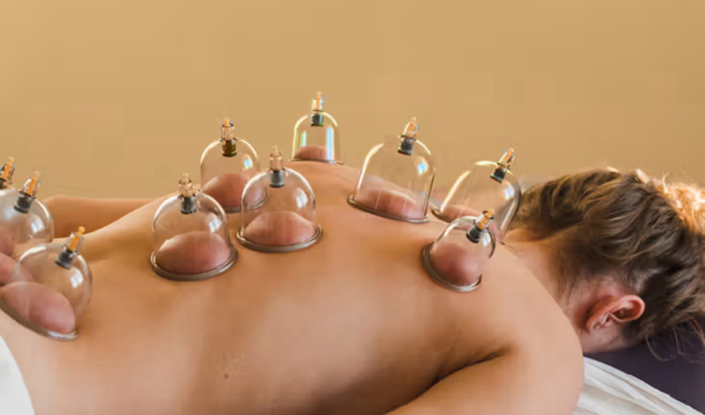 Cupping Session