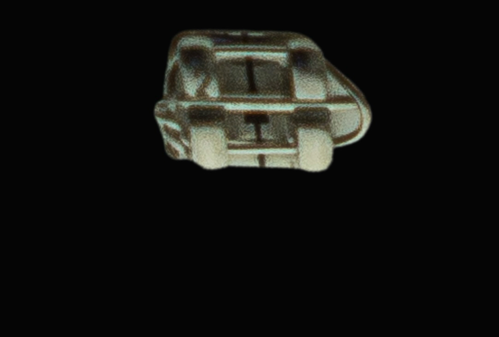 Glow Faux Ortho Bracket Repair