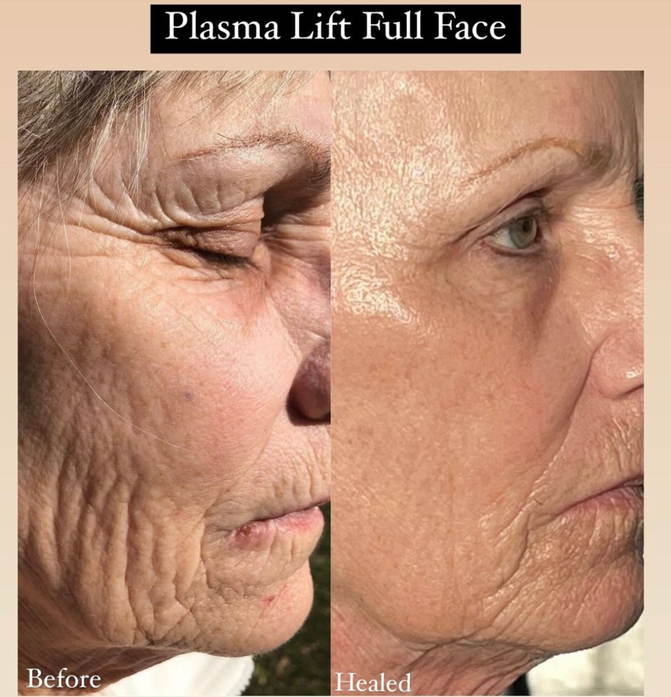 Plasma