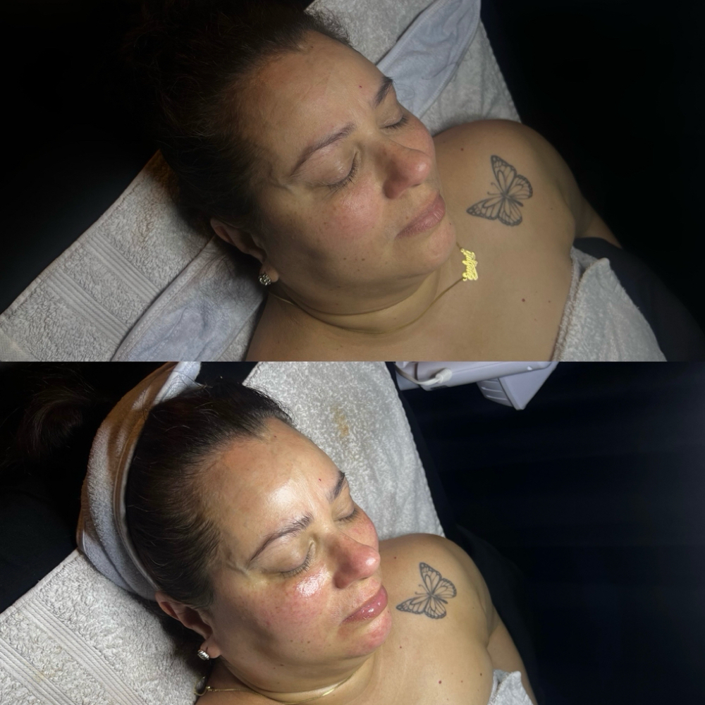 ✨NEW: The Platinum Luxe Facial ✨ at Kaida Skin + Beauty in Stony Point, NY