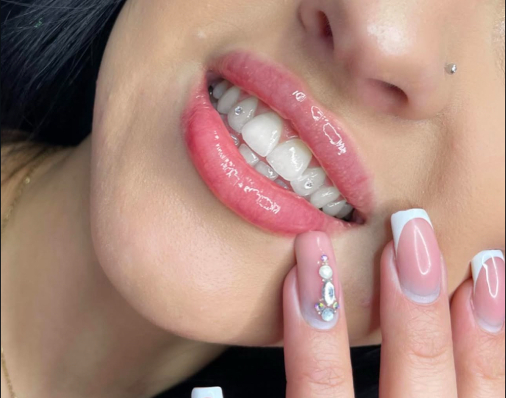One/Two tooth gems 💎