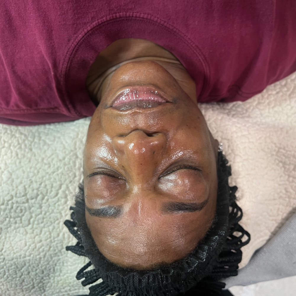 Classic Microdermabrasion
