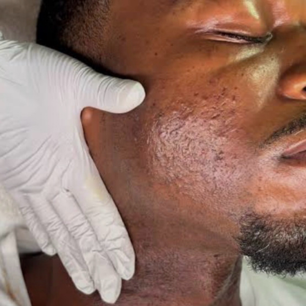 🍂Men’s Relaxing Facial at Nori Beauty Aura in Fort Mill, SC