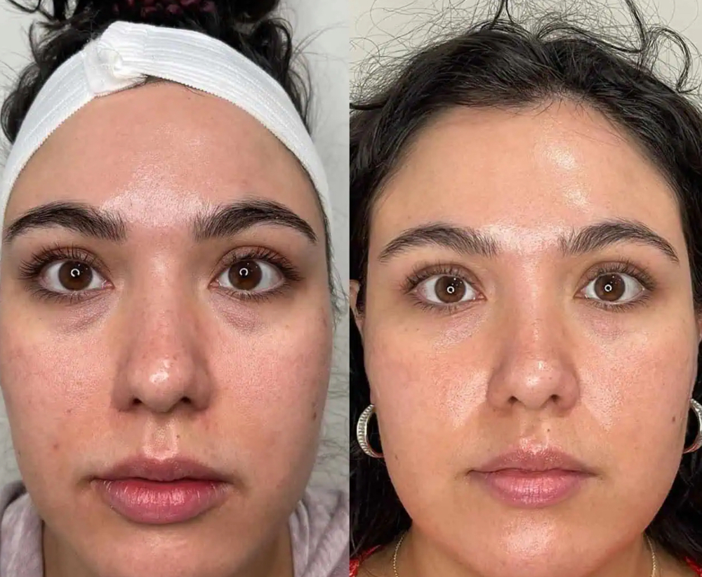 Cool Peel Eyes