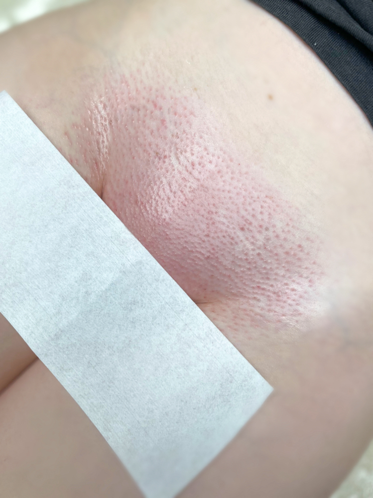 Brazilian Wax
