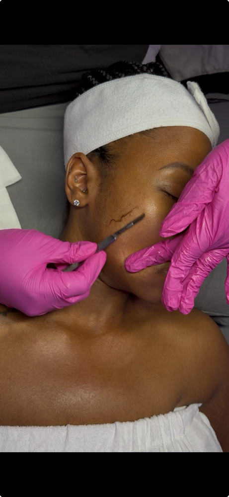 Dermaplaning Facial