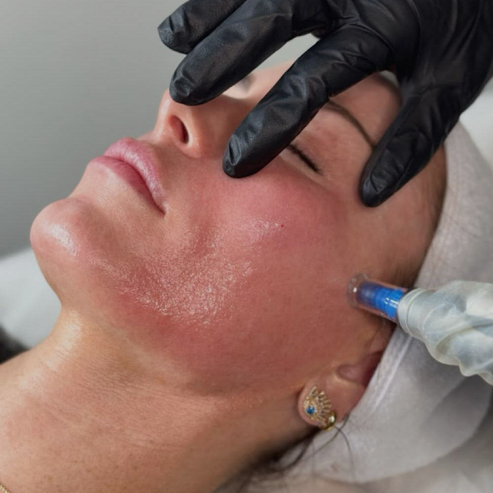 The Skin Reset at The Raq Effect in Festus, MO