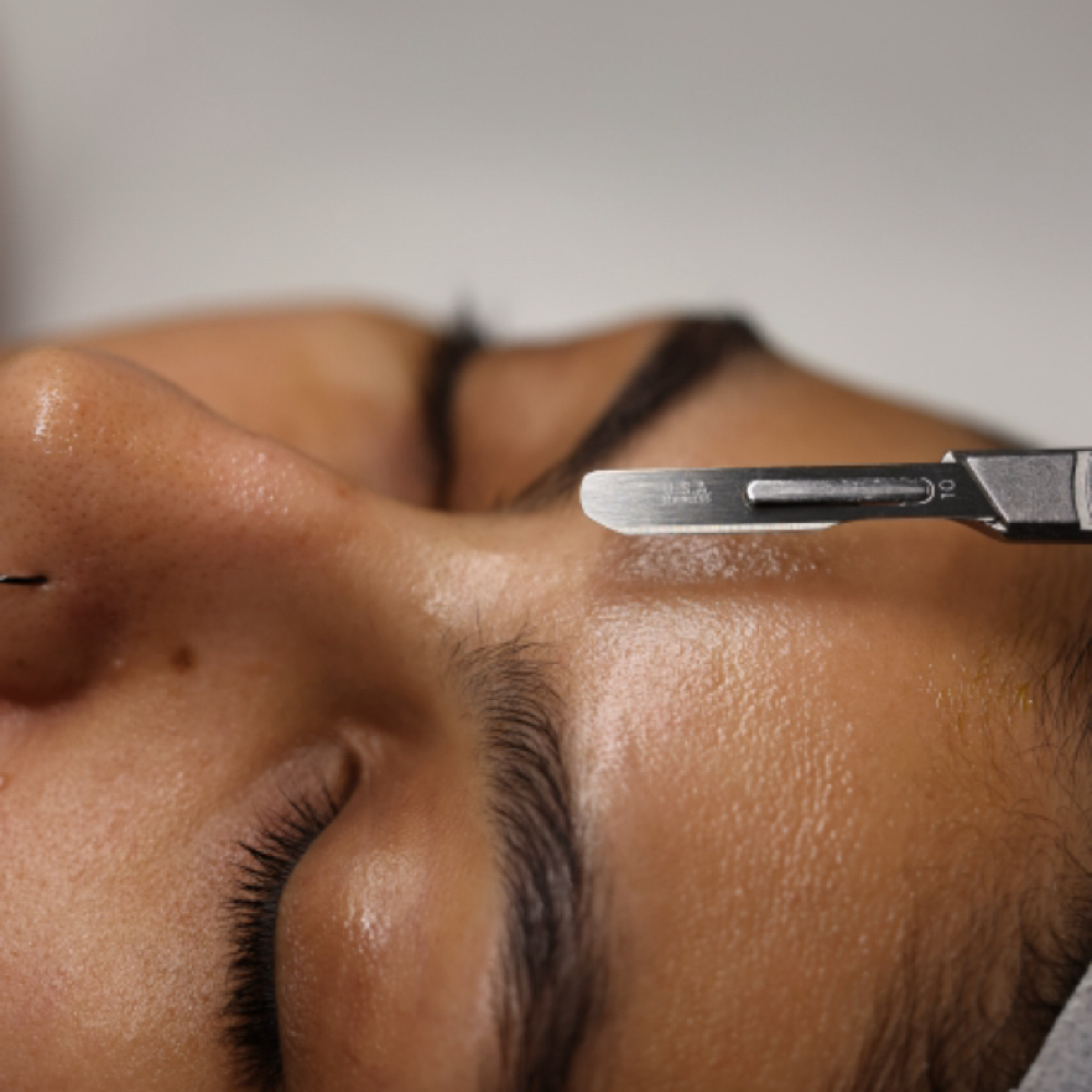 ADD ON DERMAPLANE✨