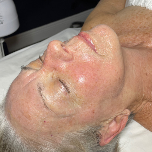 Firming Peptide Facial