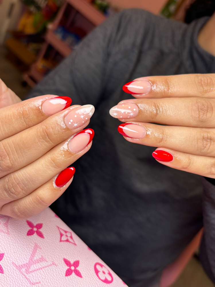 Overlay