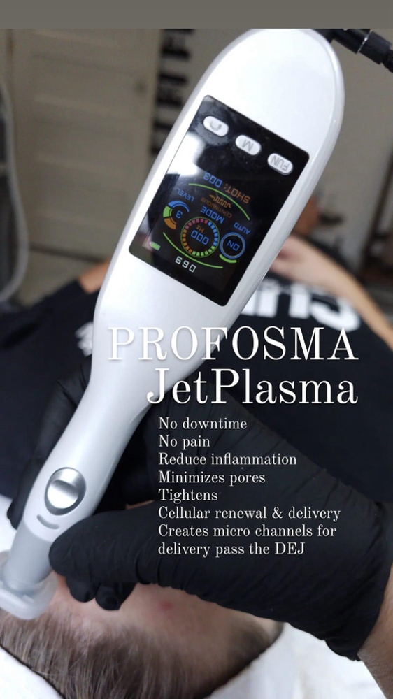 Jet Plasma Introduction