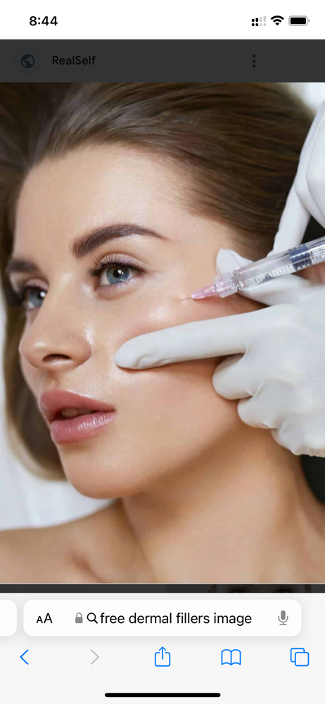 Dermal Fillers