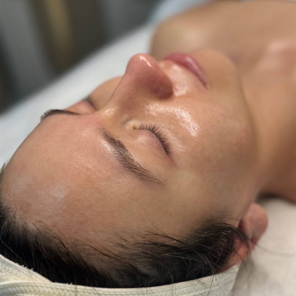 Rêvelite Glow Facial at Rêvelite Aesthetics in Temecula, CA