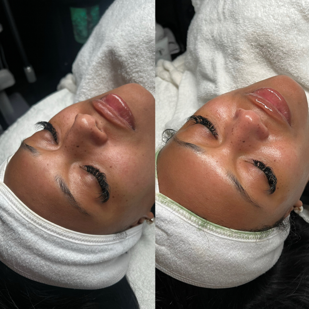 Custom Facials at Skin Therapy in Golden valley, MN