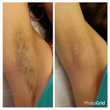 Under Arm