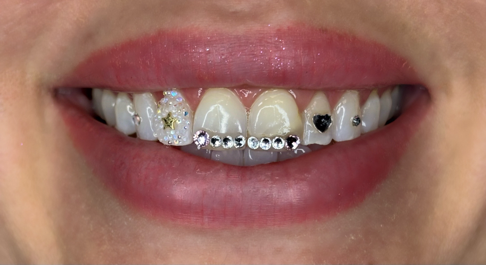10-20 Crystal Freestyle Set