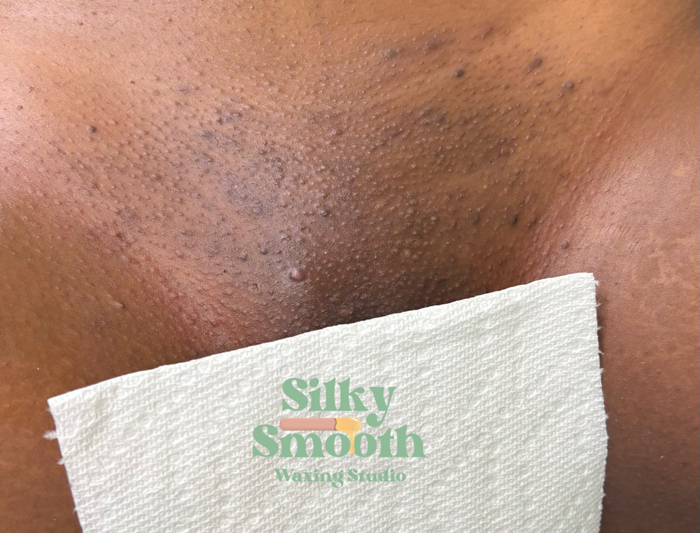 Brazilian at Silky Smooth LLC in Fort Worth, TX