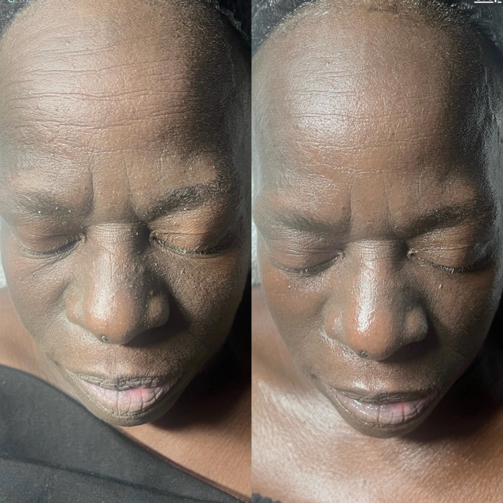 Deep Cleanse Facial