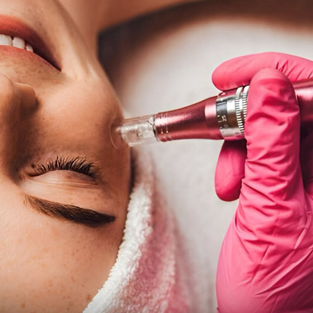 Clarifying Acne Treatment Facial at Lash by Gira LLC in yonkers, NY