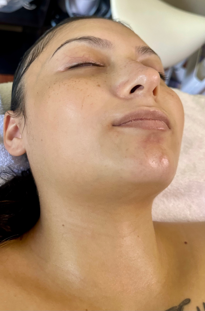 Deep Pore Cleanse at Anela Esthetics in Mountain View, HI