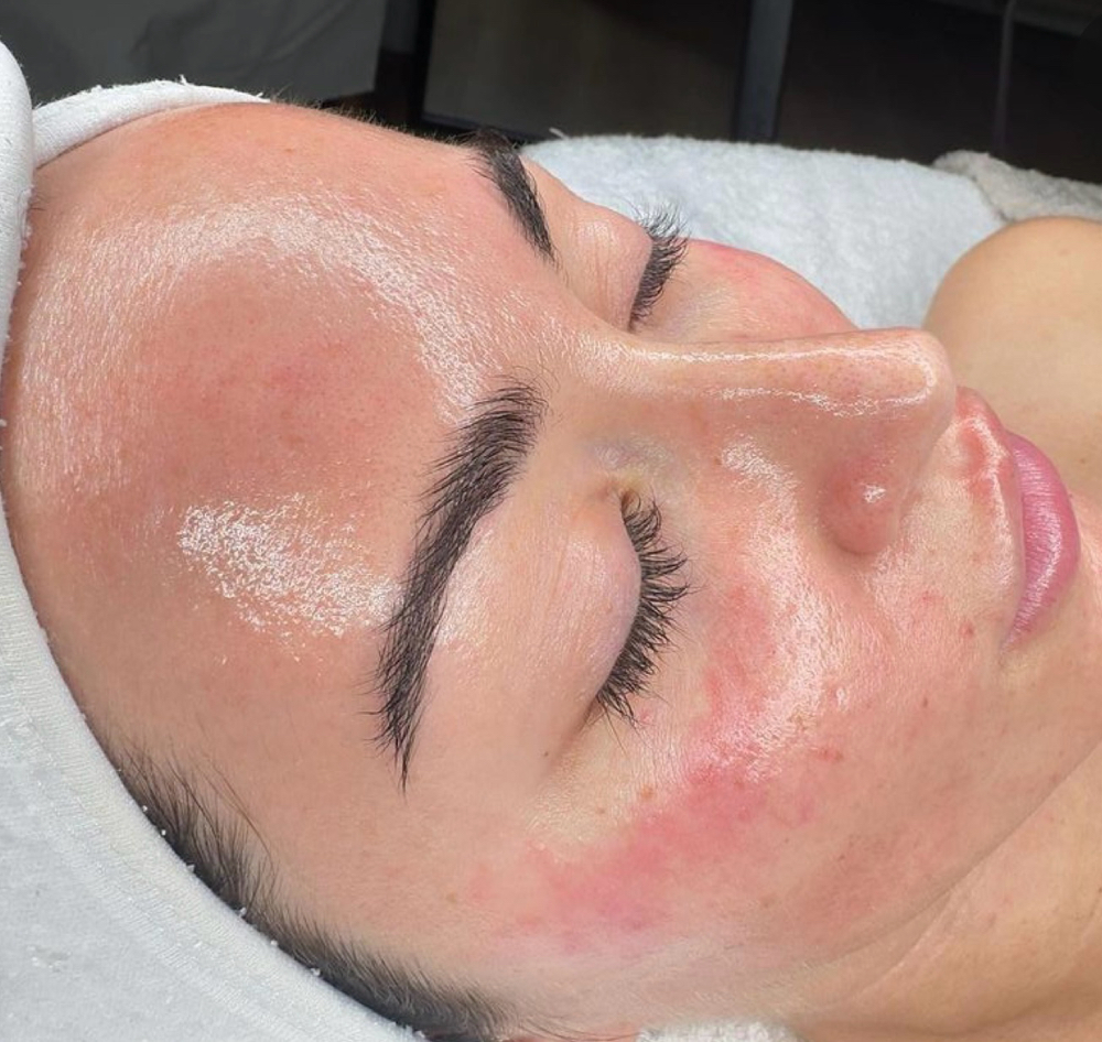 Bare Sand Facial.Facial Arena Pura