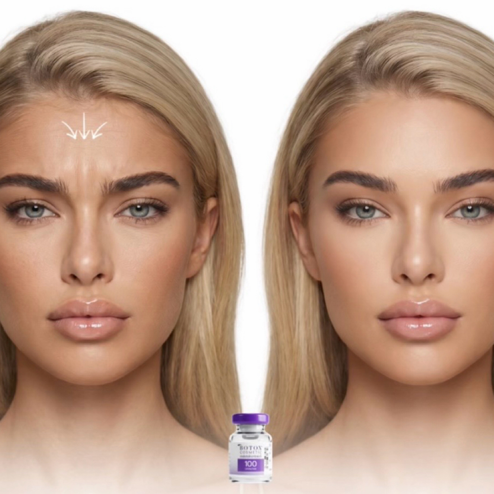 Tox Injections at Magnetic Aesthetics in Frisco, TX