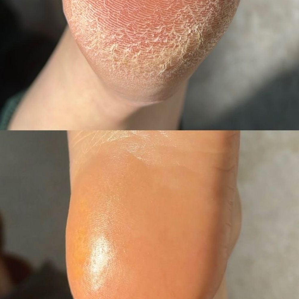 Pedicure KART at S Lux Nails LLC in Santa Clara, CA