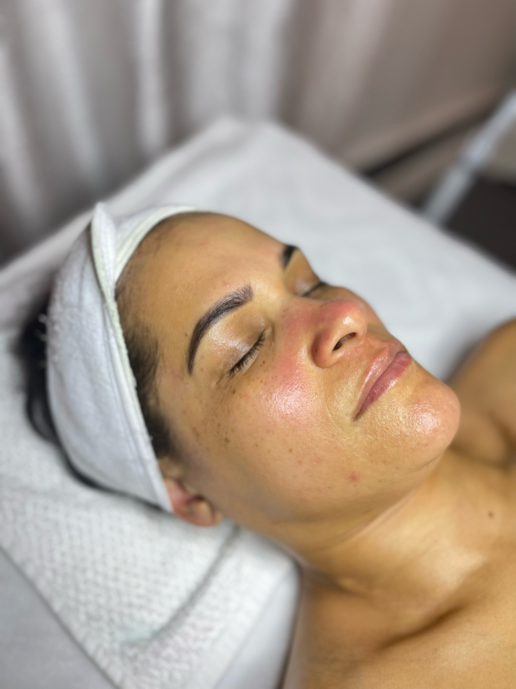 Dermaplane Facial