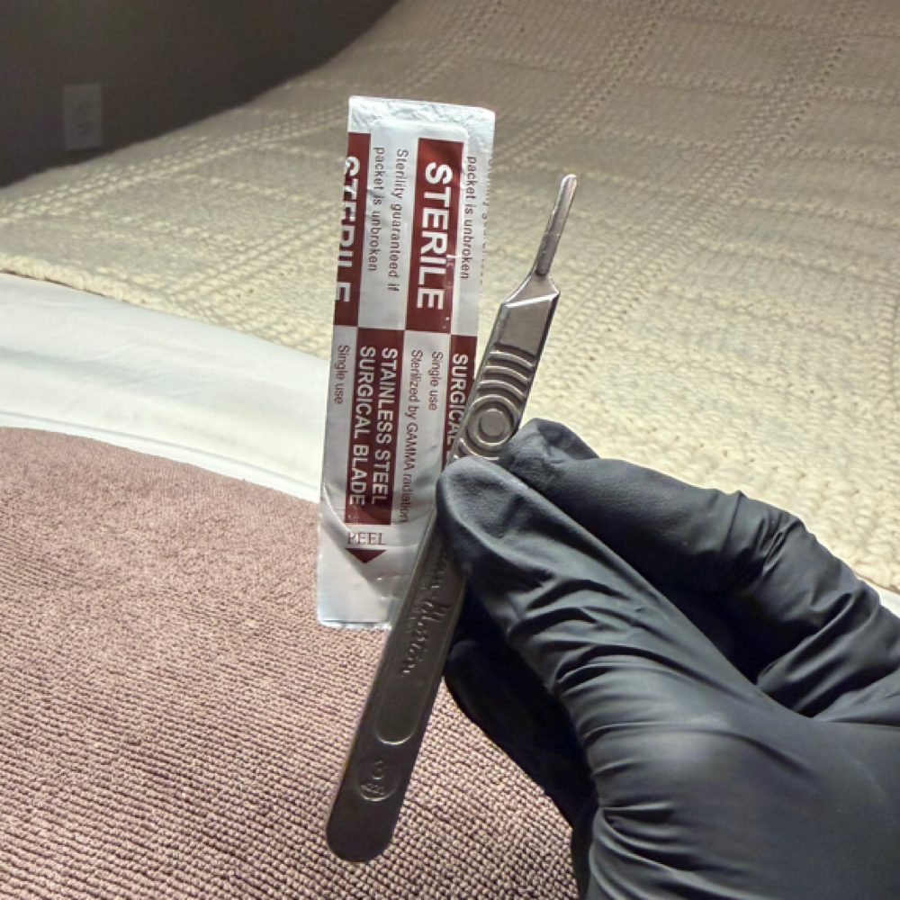 Dermaplane Facial at The Dermal Clinic in Lodi, CA