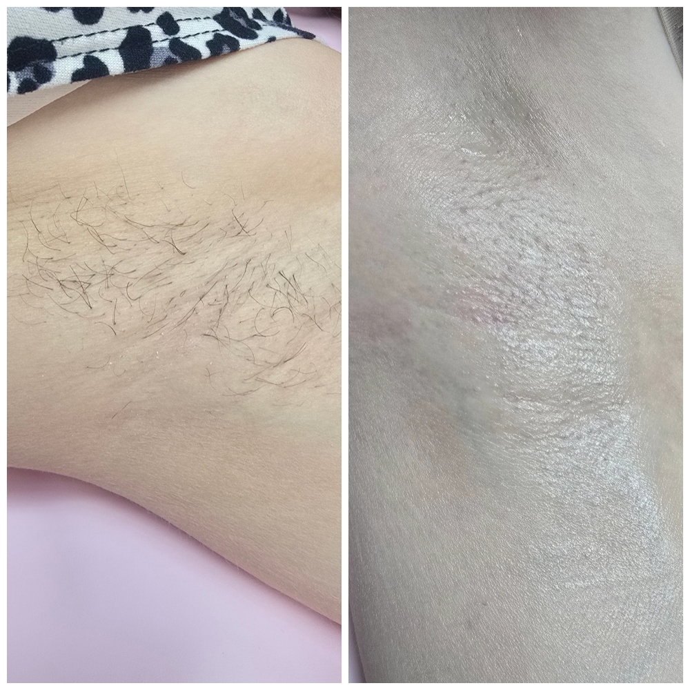Underarm Wax at The Bare Bloom Waxing Co. in Paris, TX