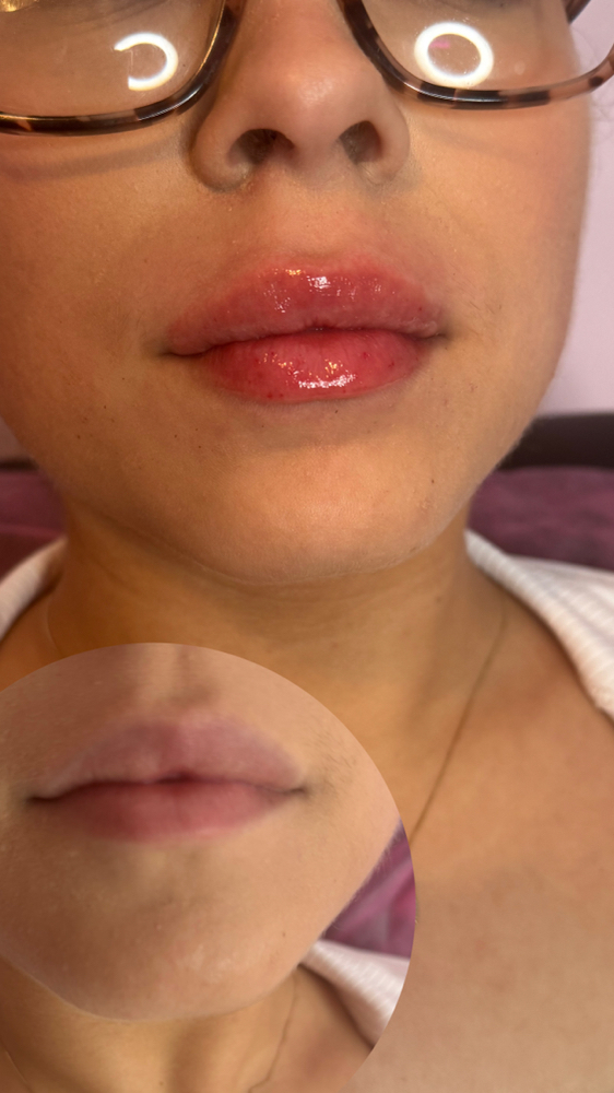 Returning Client Touch Up🫦✨ 1.5ml