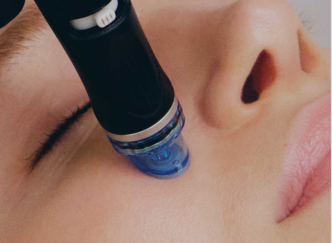 Wet Diamond Microdermabrasion