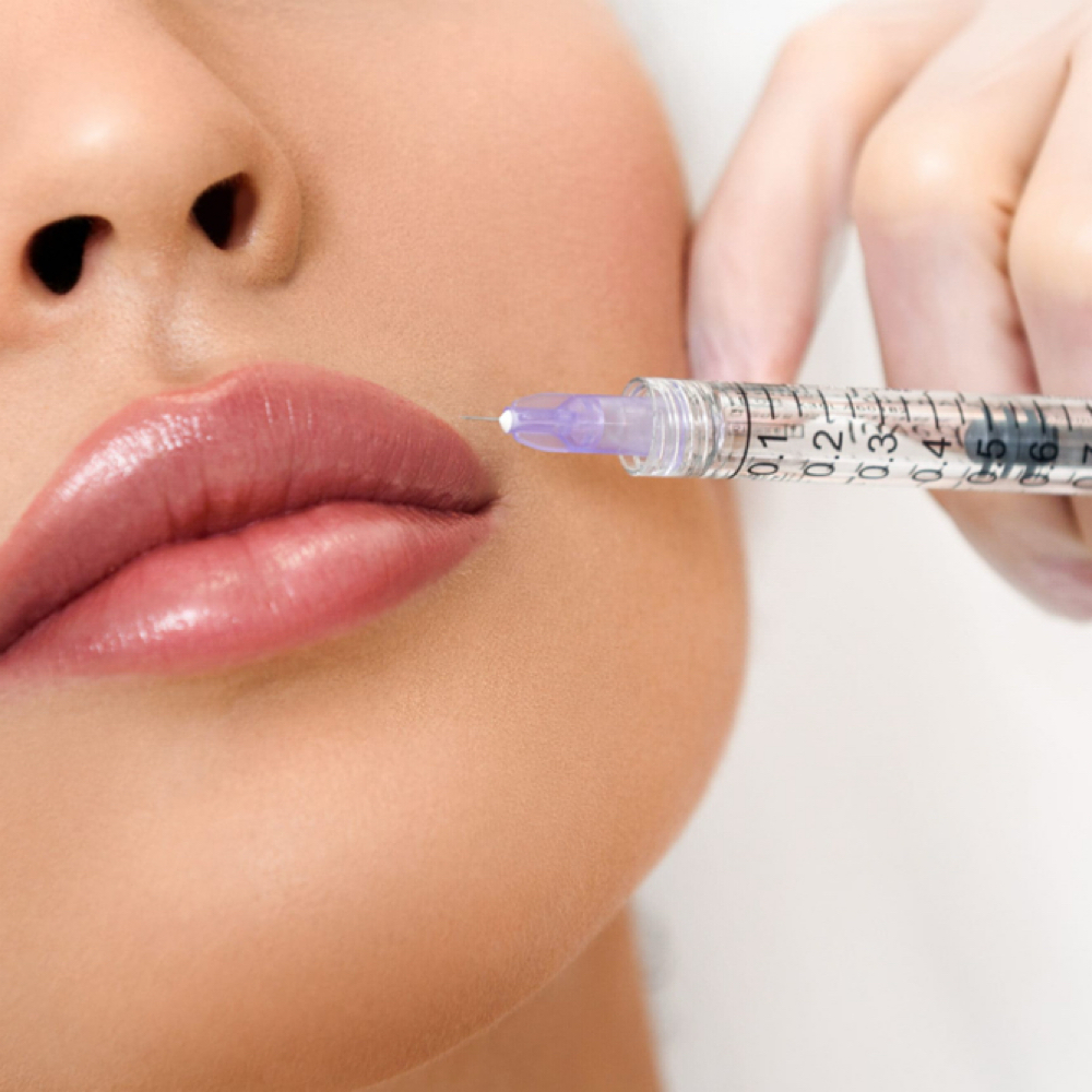 Botox Lip Flip at Unique Clinique Aesthetics in Brooklyn, NY