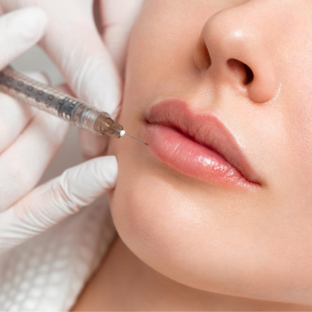 Juvederm Volbella XC at Dinah Manalo, NP - Aesthetic Medicine in Yakima, WA