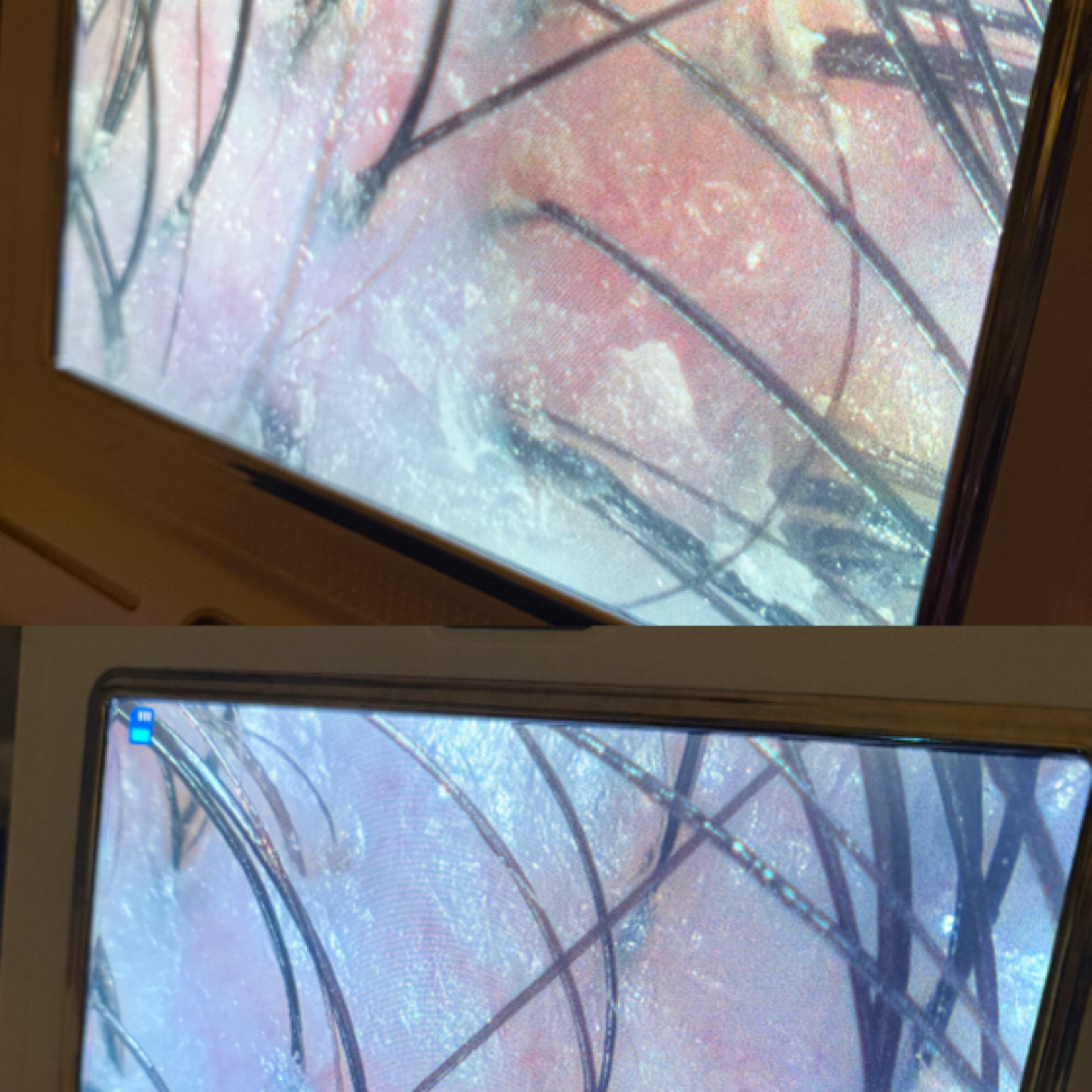 Scalp Analysis at Aura Luxe Headspa in East Hartford, CT