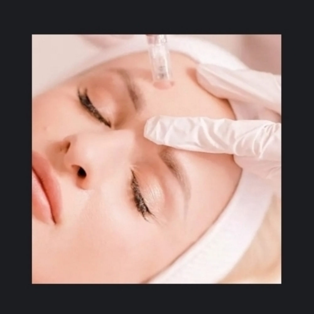 Micro-Channeling at Skin & Toxx Medical Spa Westchase in Houston, TX