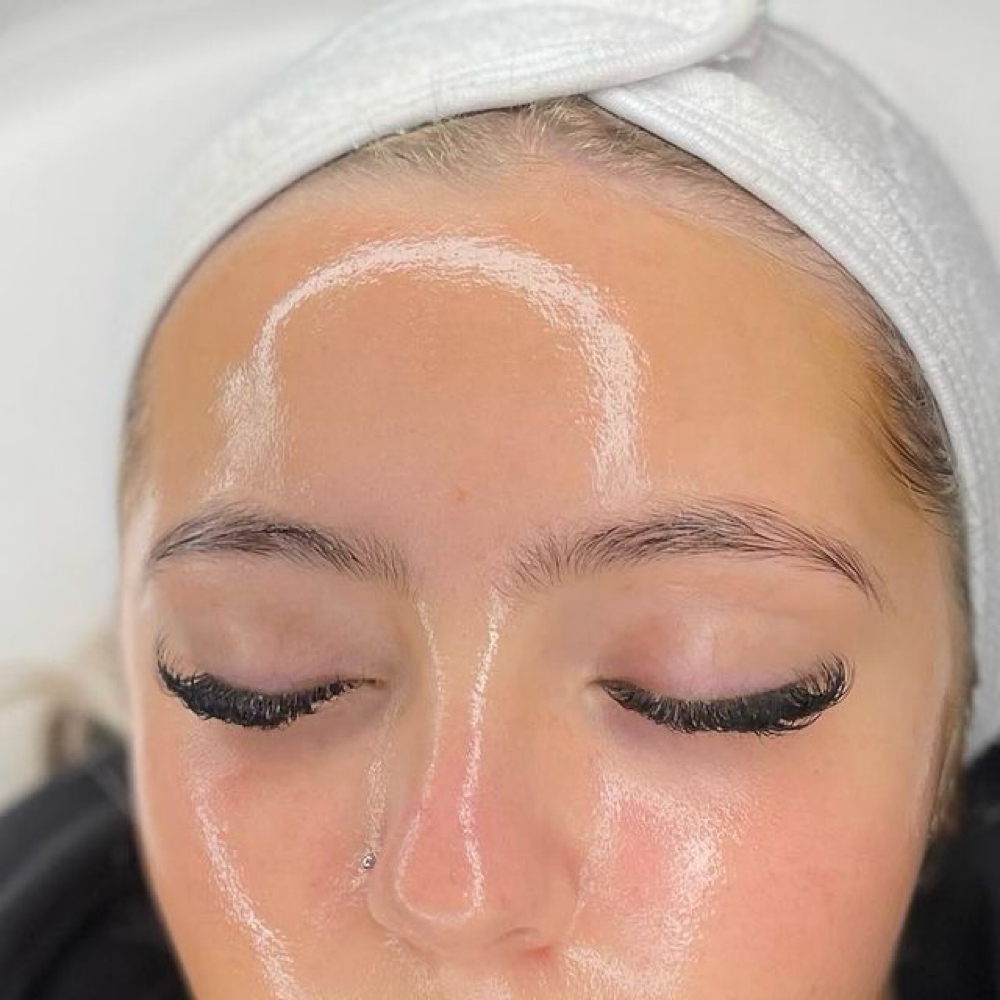 Dermapeel at Skin Church in chicago, IL