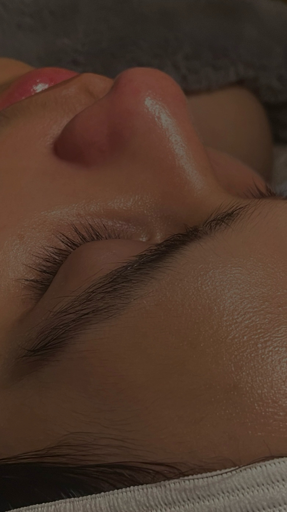 Acne Clearing Facial