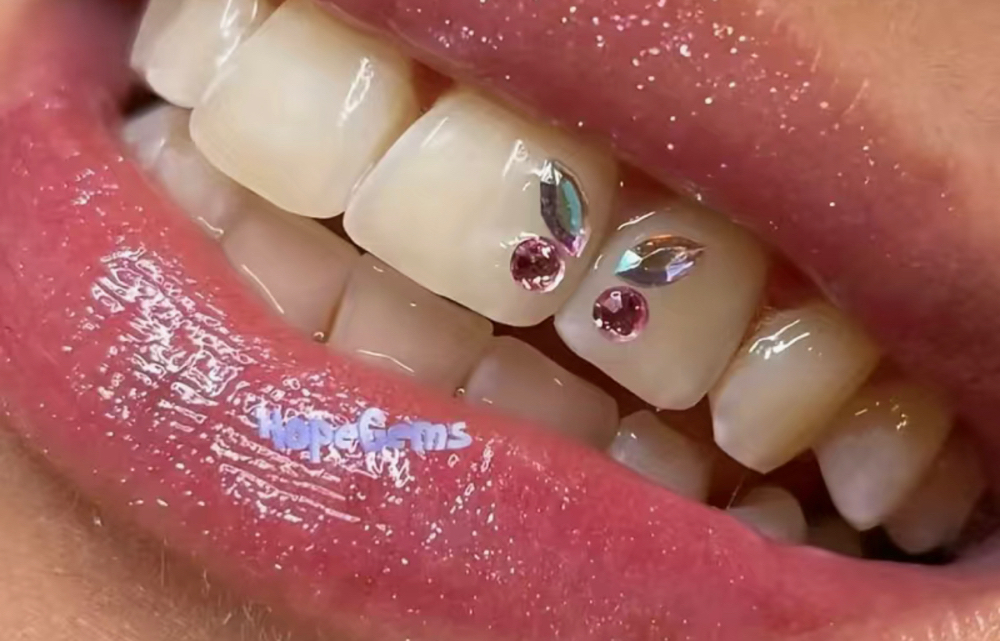 Tooth Gems (5-10)