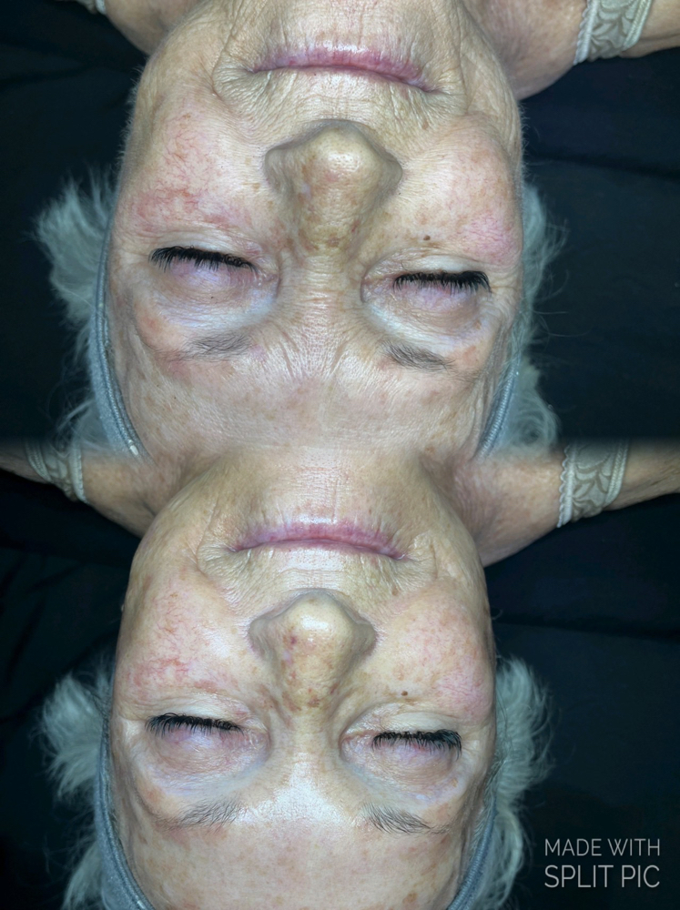 Age Me Pretty Facial
