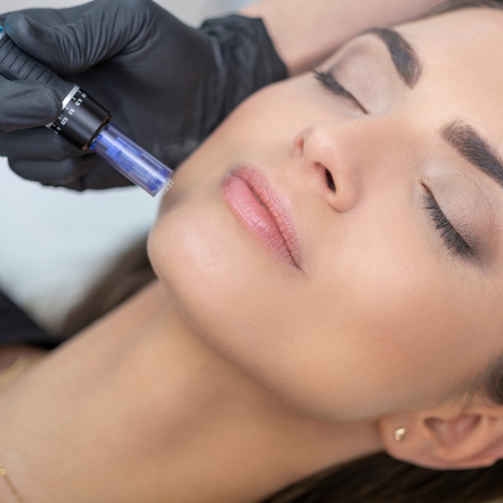 Nano Needling Facial at 121 Studio in Marshall, IL