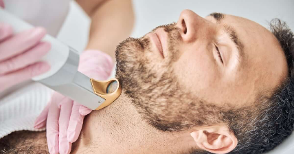 Depilacion De Laser En Cuello