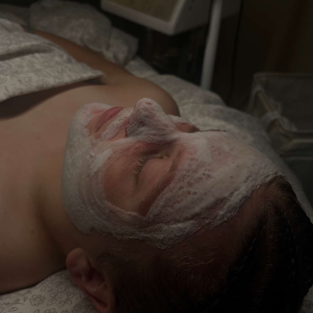 Acne Bootcamp at Karly’s Esthetics in Roscommon, MI