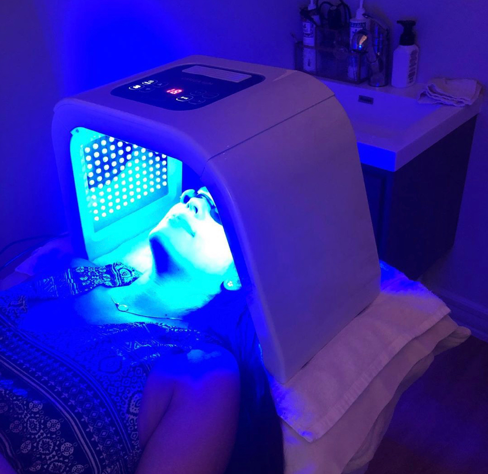 Photofacial LED Light Therapy