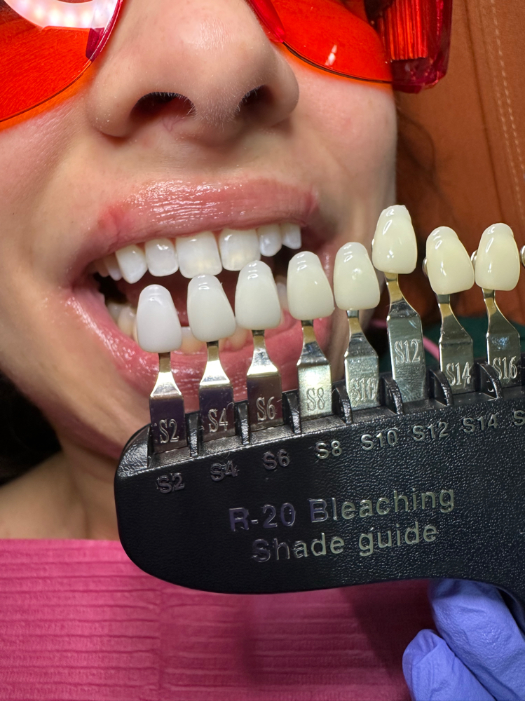 TAN AND TEETH WHITENING SPECIAL!!!