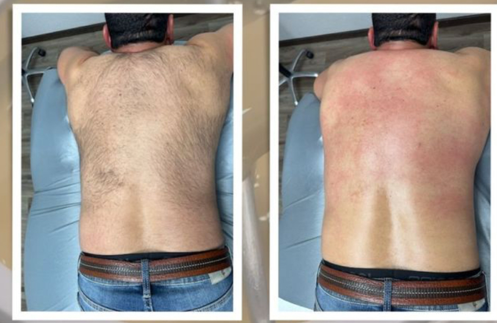 Back Wax
