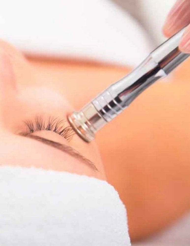 Microdermabrasion