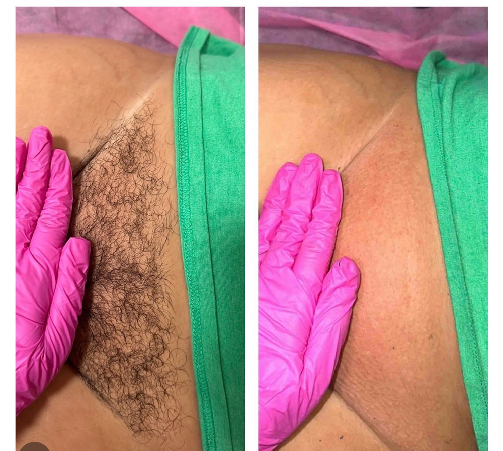 Brazilian Wax at GLOW Spa Tanning & Fitness in Owego, NY